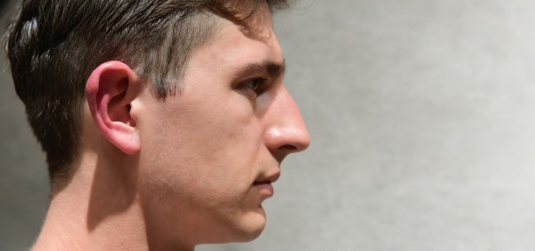 Banner 7 Issues That Ear Surgery Can Correct