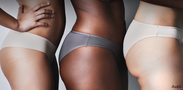 Banner Avéli: A New One time Permanent Cellulite Treatment
