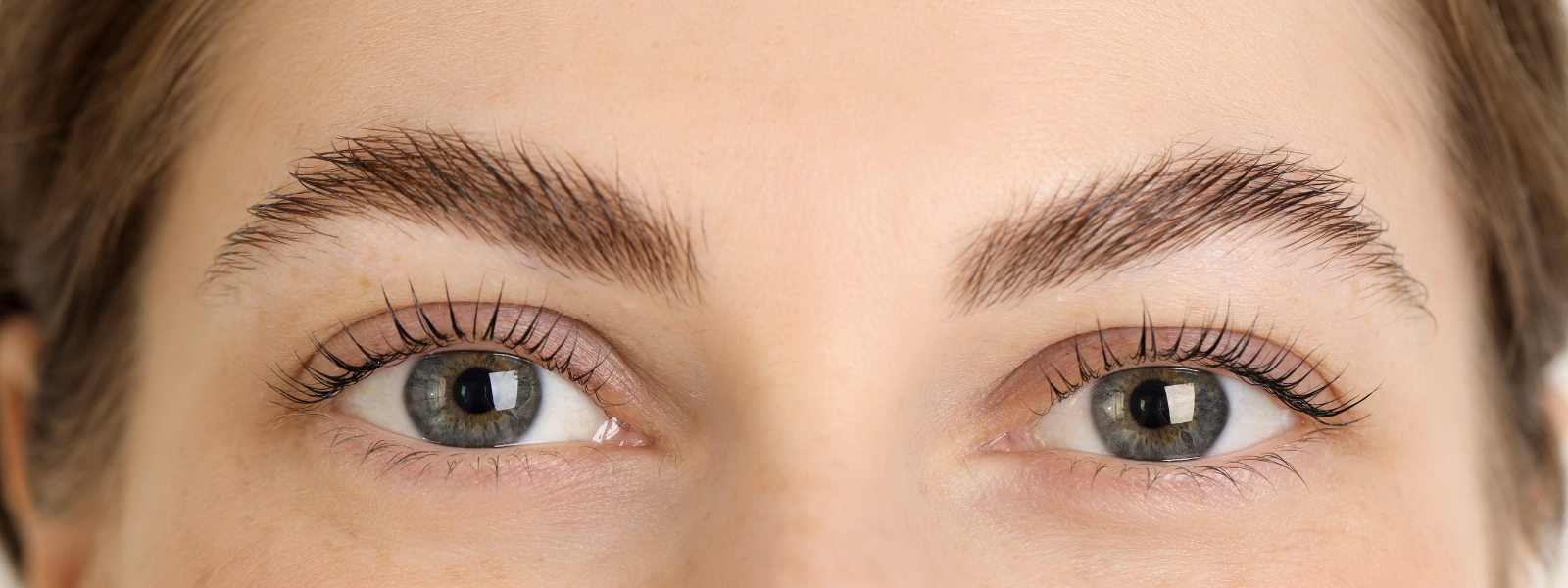 Banner What Is the Best Age to Get an Eyebrow Lift?