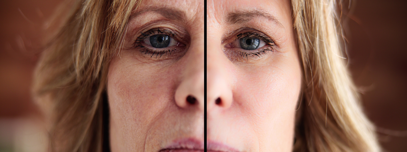 Banner Combining Facelift with Eyelid and Neck Surgery for a Complete Makeover