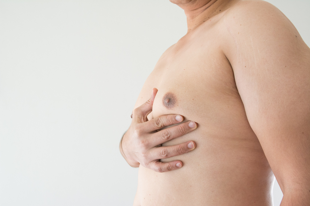 Banner Comparing Surgical vs. Non-Surgical Gynecomastia Treatments