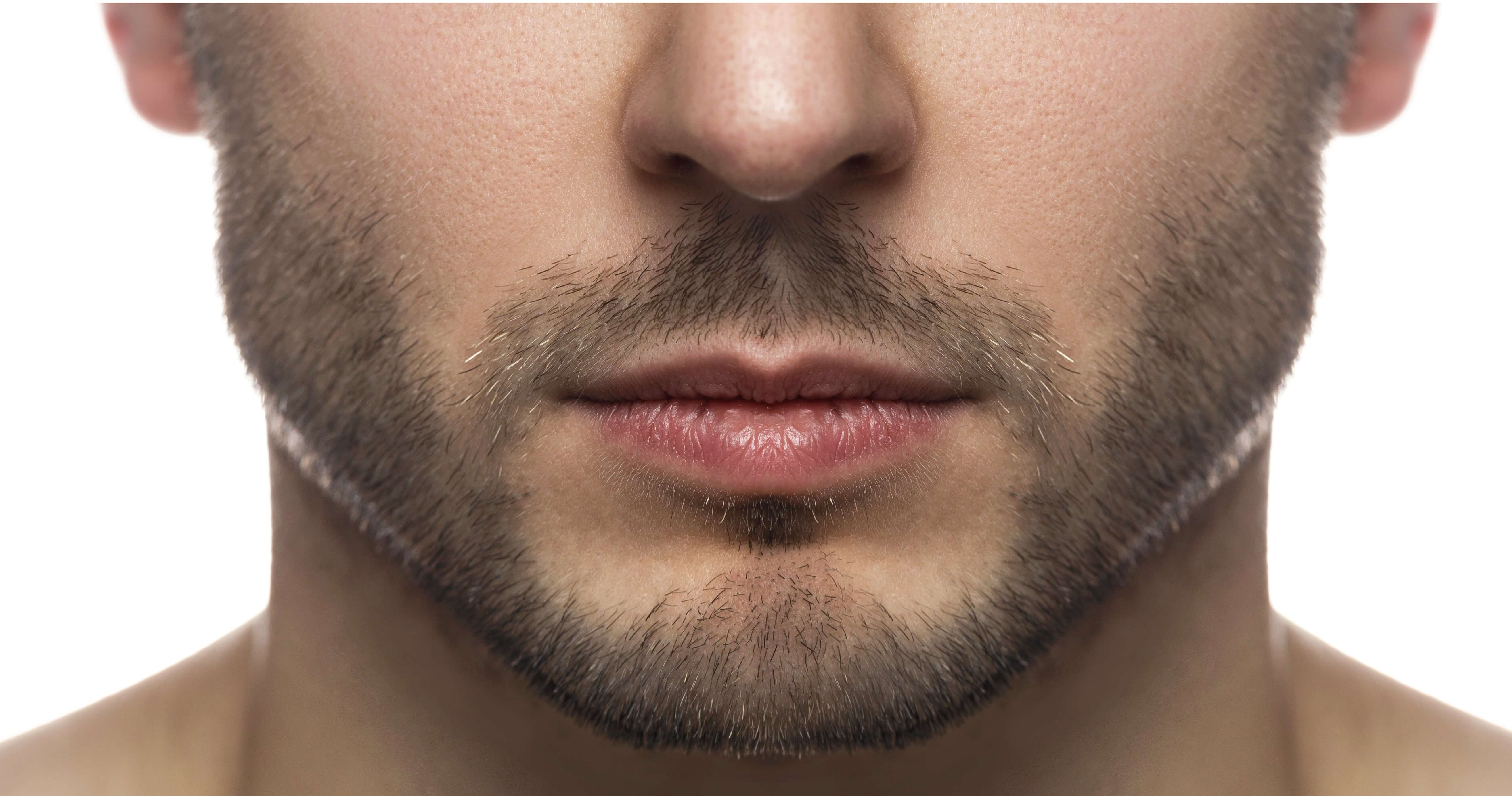 Banner Jawline Chin Contouring for Men: An Incredible Transformation