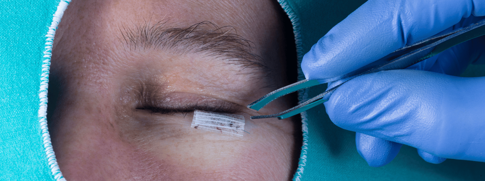 Banner Lower Eyelid Surgery vs. Upper Eyelid Surgery