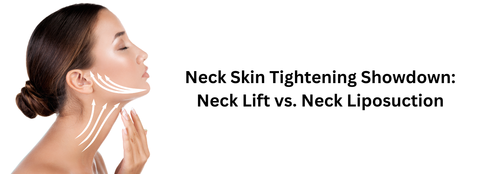 Banner Neck Skin Tightening Showdown: Neck Lift vs. Neck Liposuction