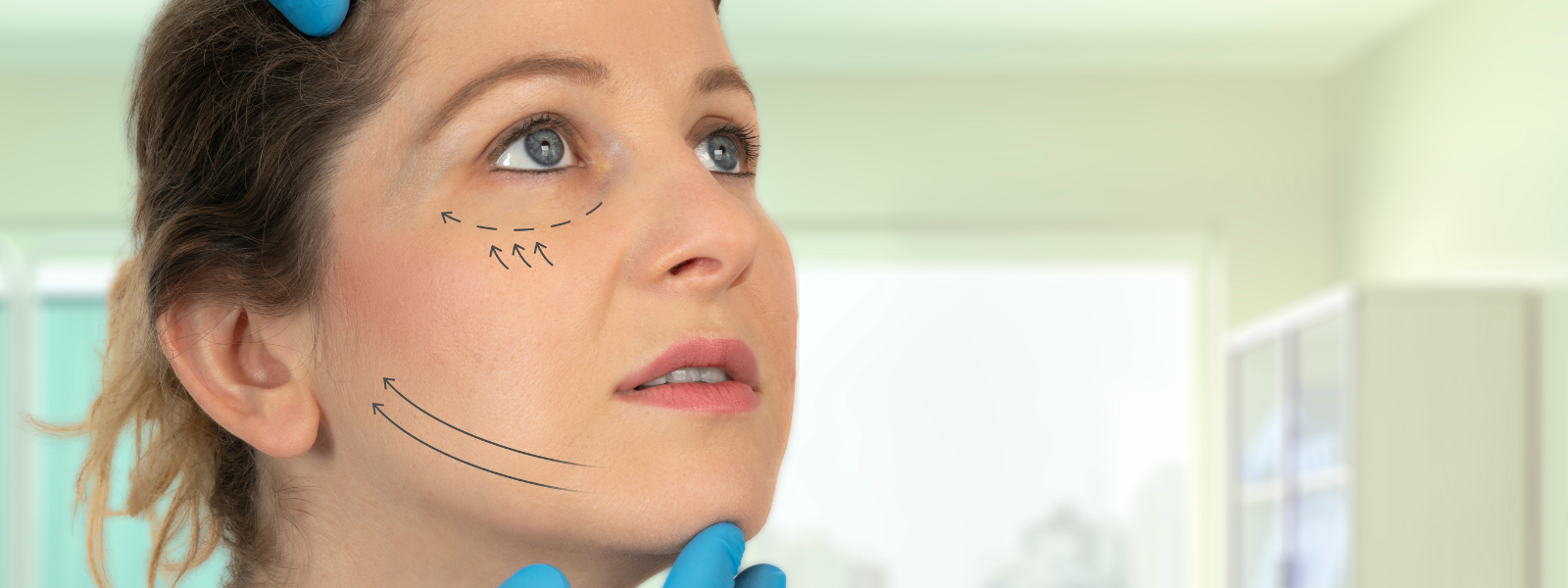 Banner The Art of Facelifts: Techniques and Outcomes