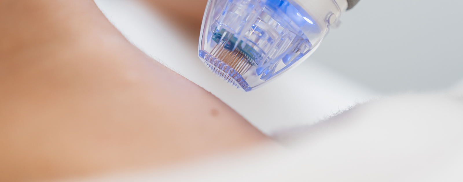 thumbnill 8 Proven Ways to Maintain Your Neck Lift Results for Years