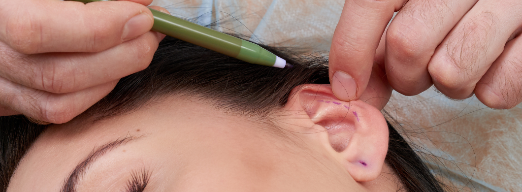 thumbnill Advancements in Scarless Ear Surgery Techniques