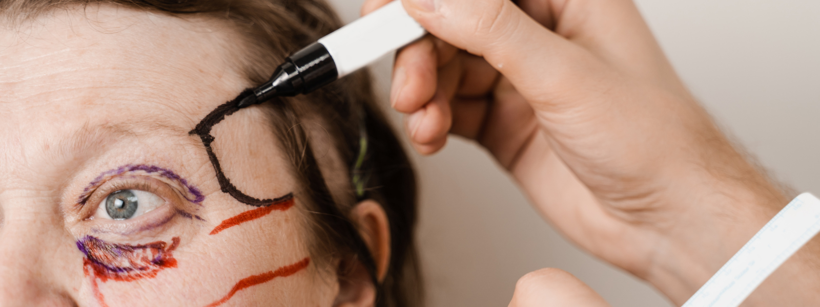 thumbnill Brow Lift Surgery: Is It Right for You?