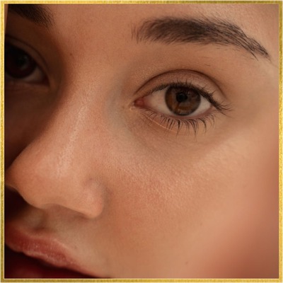 Eye Cream Isn’t Enough for Dark Circles—Try Eyelid Surgery