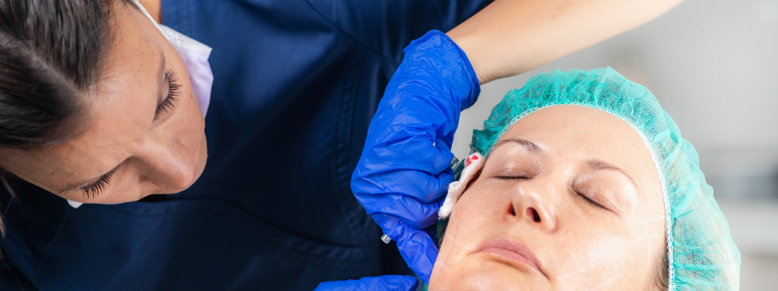 Fat Transfer to Face FAQ Guide: Answers to Questions About Facial Fat Grafting