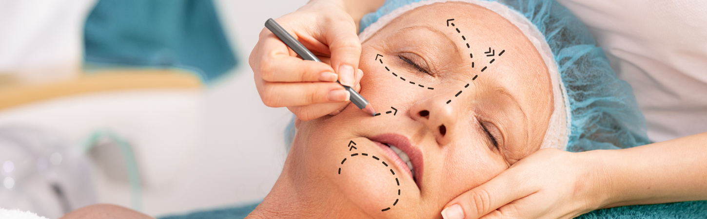 Top 5 Facial Areas That Benefit Most from Fat Transfer to Face