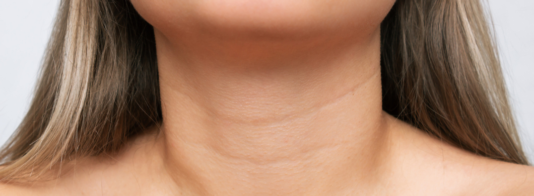 What Makes a Good Candidate for a Neck Lift?