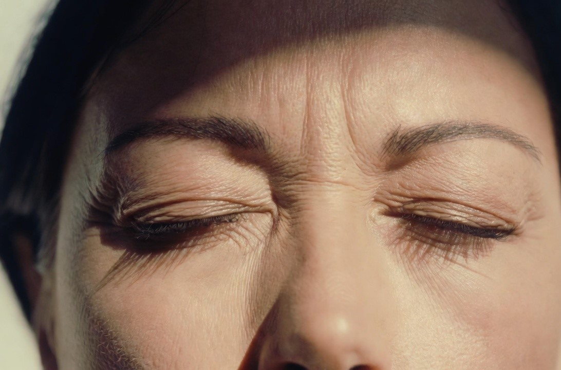 Will Revision Eyelid Surgery Create a New Scar?