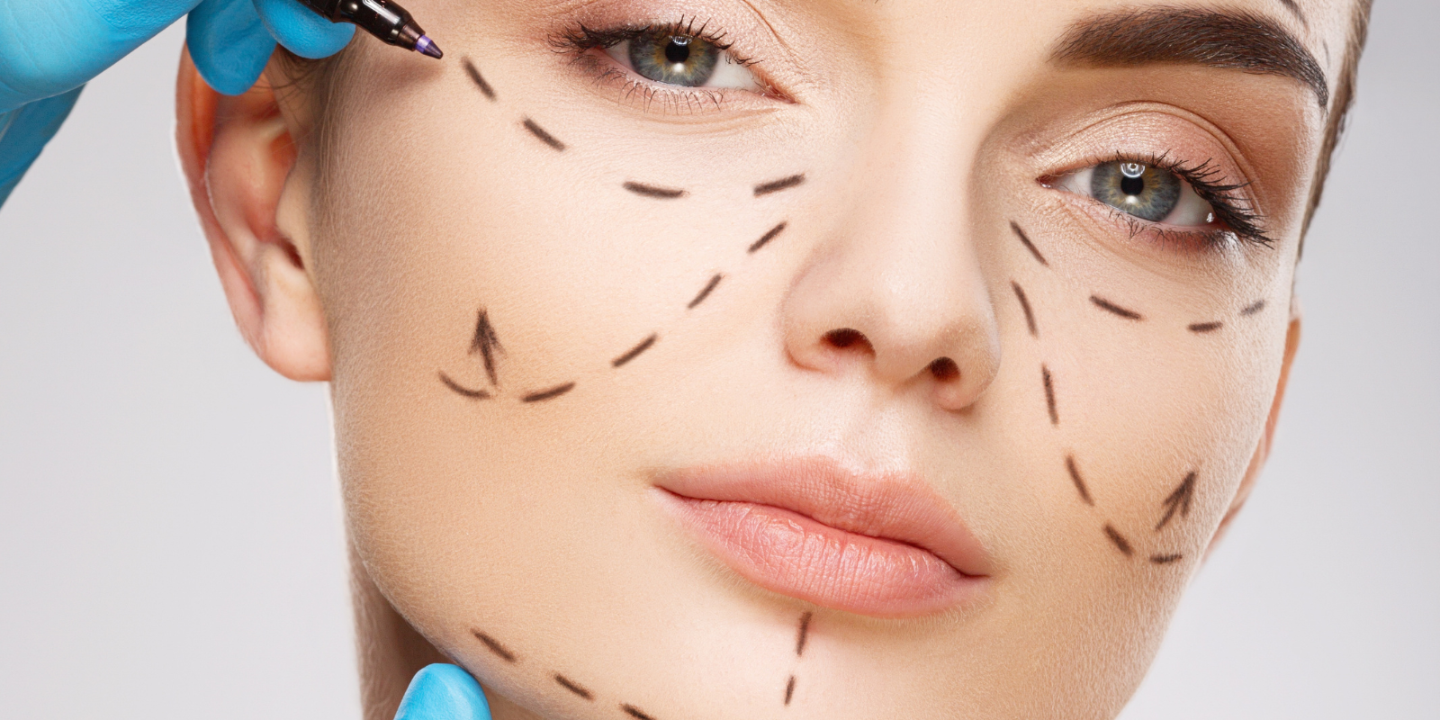 Your First Facelift in Your Mid Age? A Guide to Realistic Expectations and Your Recovery Timeline 