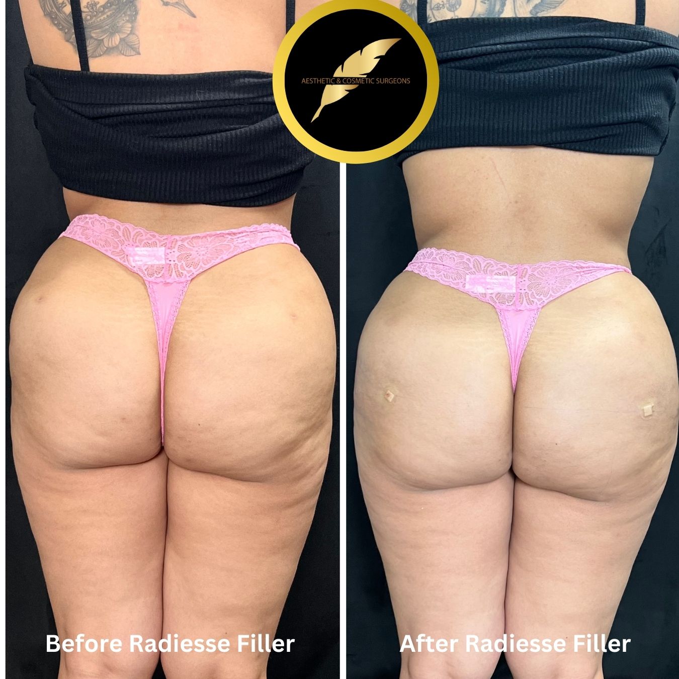 Aesthetic and Cosmetic Surgeons Portfolio