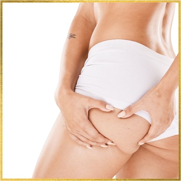 CELLULITE TREATMENT 