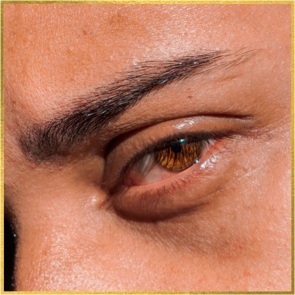 After Blepharoplasty Procedure: