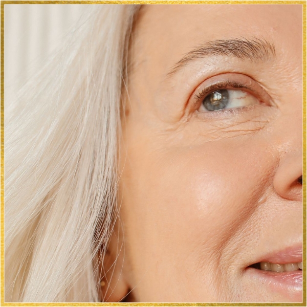 Eyelid Surgery in San Diego