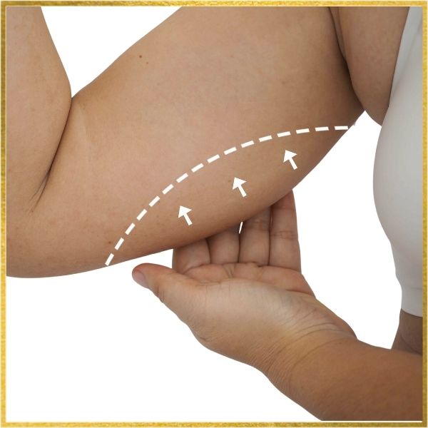 Awake VASER Liposuction in Dana Point