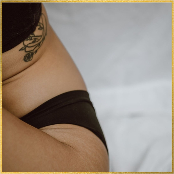 Awake Mini Tummy Tuck in Dana Point