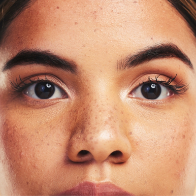 What Are the Benefits of a Brow Lift Surgery?