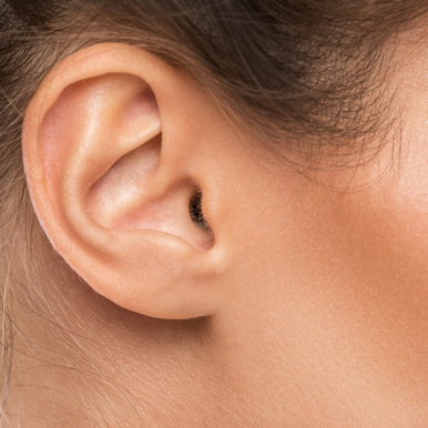 Recovery After Otoplasty Treatment